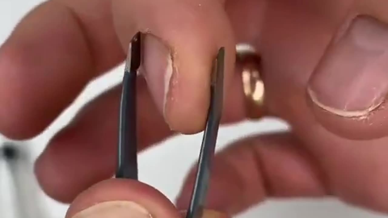 Useful tip for removing splinter…