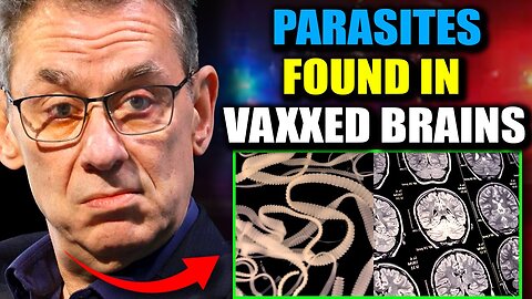 Scientists Discover "Parasitic Entities" in Brains of Jabbed - Media Blackout