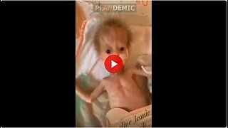 Are the black eyed babies of vaccinated women Human-Alien Hybrids?