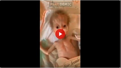 Are the black eyed babies of vaccinated women Human-Alien Hybrids?