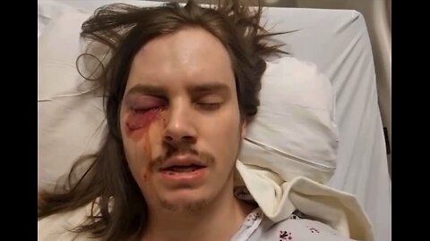 “No Kings” rioter may lose his eye. Play stupid games. Win stupid prizes.