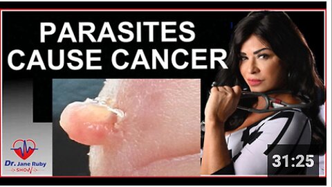 "Parasites Identified as the Cause of Cancer"