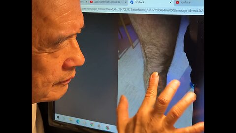 Luodong Gives Online Treatment To Man For Knee Pain