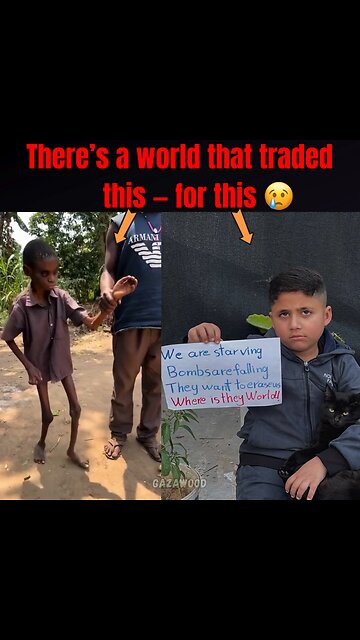 REAL Starvation vs Fat kid in Gaza - Which one are you protesting for?