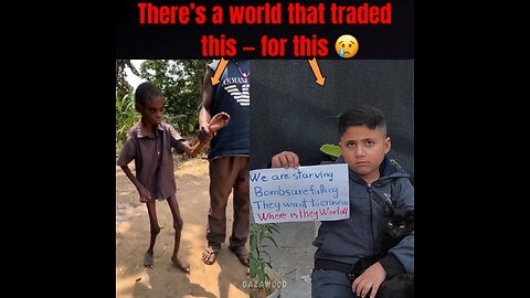 REAL Starvation vs Fat kid in Gaza - Which one are you protesting for?
