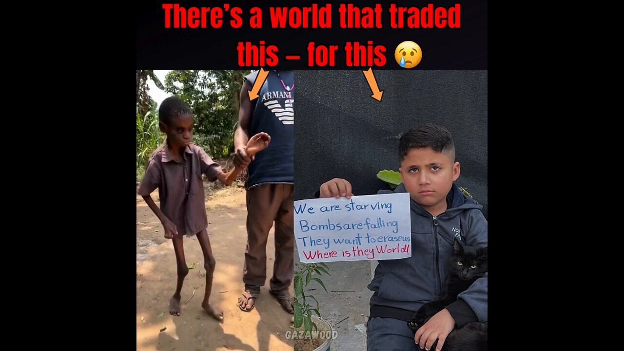 REAL Starvation vs Fat kid in Gaza - Which one are you protesting for?