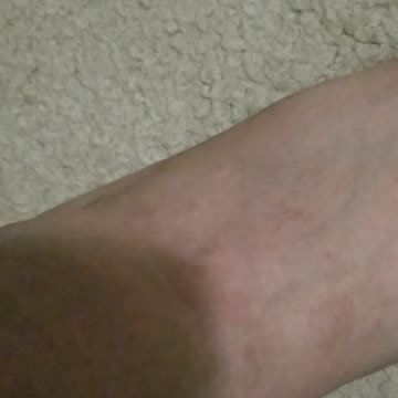 the evil aliens told the probation officers to put lice, fleas and scabies all over my room! part 2