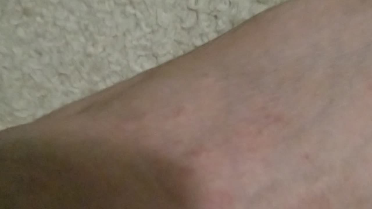 the evil aliens told the probation officers to put lice, fleas and scabies all over my room! part 2