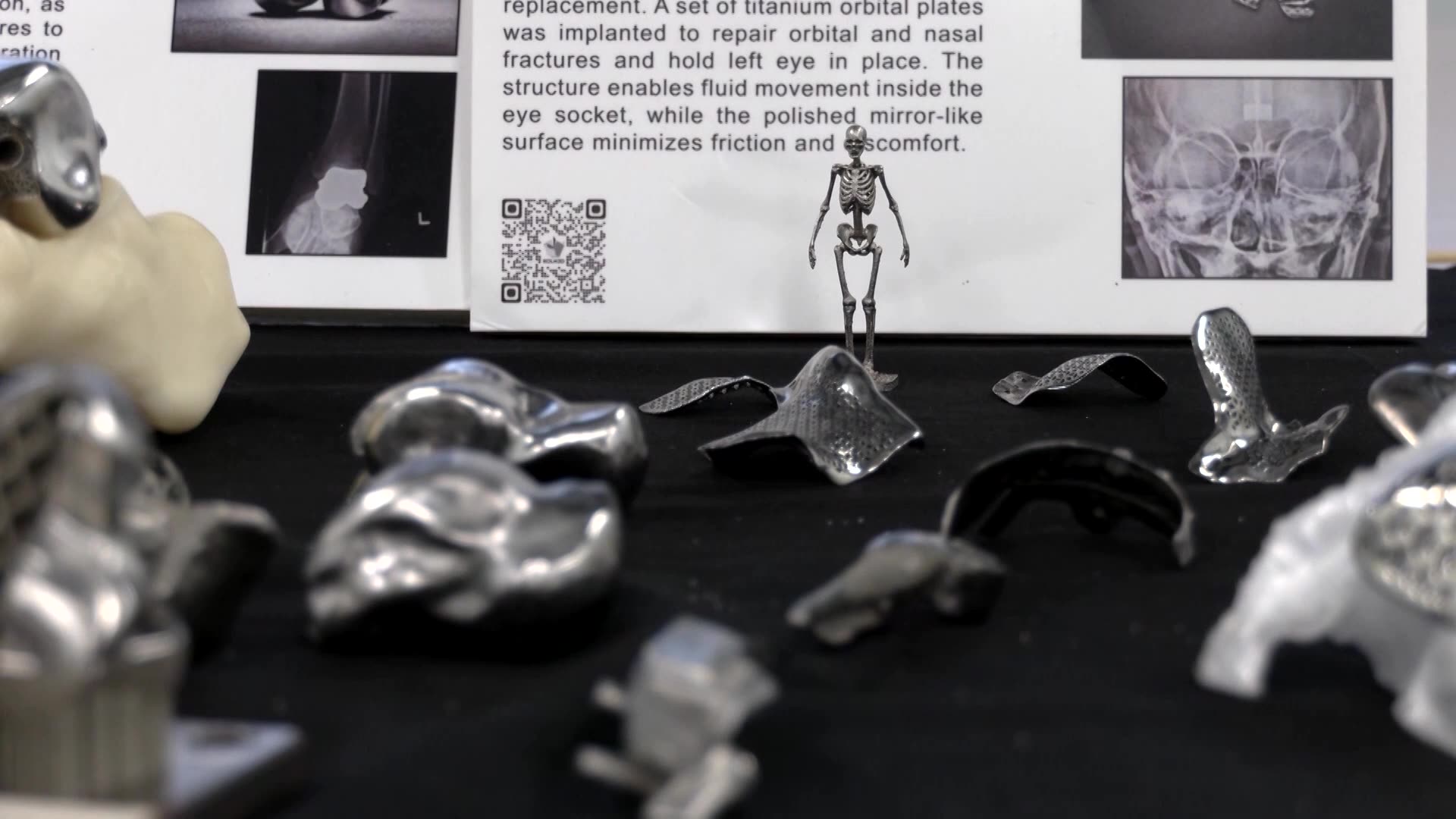 Researchers say AI-powered medical imaging tech could cut radiation exposure