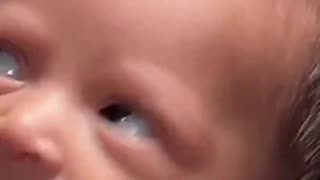 When you're just born and life's already bothering you