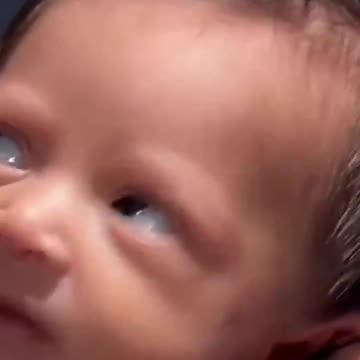 When you're just born and life's already bothering you