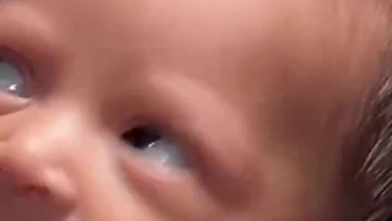 When you're just born and life's already bothering you