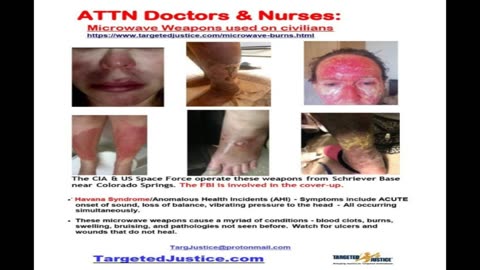 OMG! IGNORED! TI DAY PROTESTS! THE SHOCKING TRUTH TOLD IN SECONDS! NWO! BRIEF!