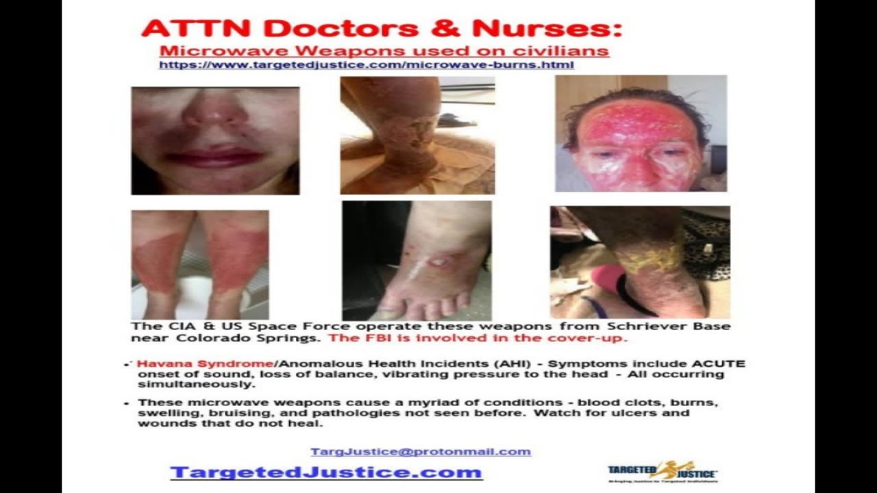 OMG! IGNORED! TI DAY PROTESTS! THE SHOCKING TRUTH TOLD IN SECONDS! NWO! BRIEF!
