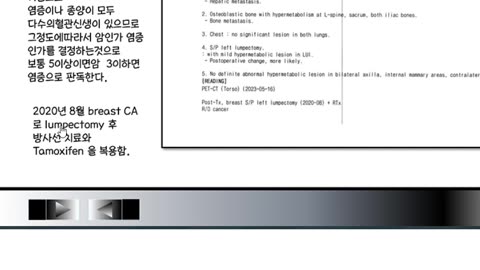 유방암환자 호르몬적인 항암제 치료에서도 프로게스테론부족타목시펜 태음인, 여성호르몬과잉소양인 아로마타제억제제, 소음인이 현격하게 구분된다.