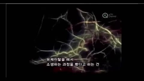 100% 과학적 죽음 상태에서의 임사 체험! 팸 레이놀즈!