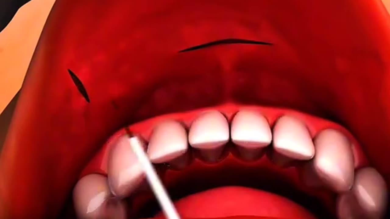 Why Do Doctors Remove the Thyroid Watch How This Life-Changing Surgery Works!