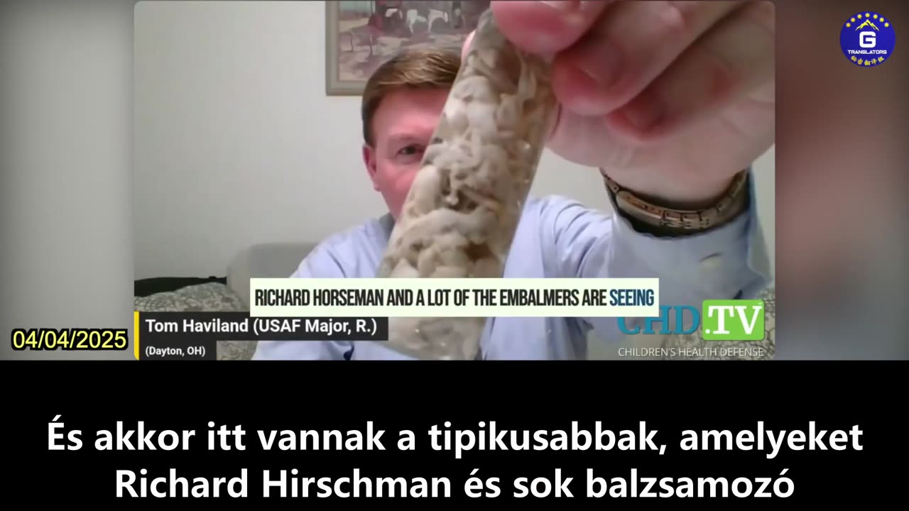 【HU】2024-ben a balzsamozók 83%-a fehérrostos vérrögöket látott az elhunytban
