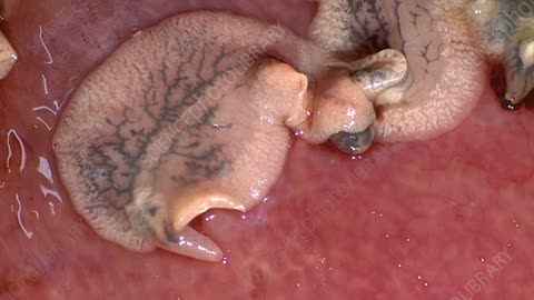 Adult liver fluke (Fasciola hepatica) on the surface of a freshly-killed sheep liver.