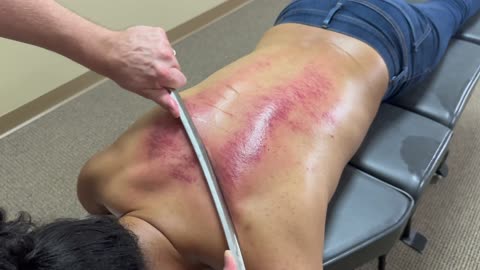 FLATTENING ALL THE KNOTS