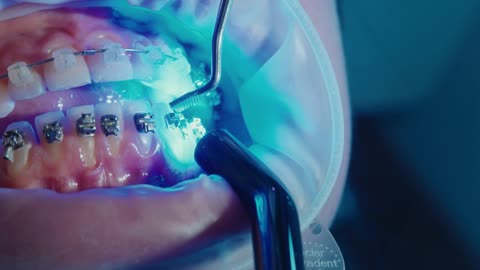 Top Orthodontist in Dubai | AQR Orthodontics – Braces, Invisalign & Smile Design