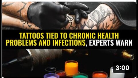 "Experts Warn: Tattoos Linked to Chronic Health Issues and Infections"