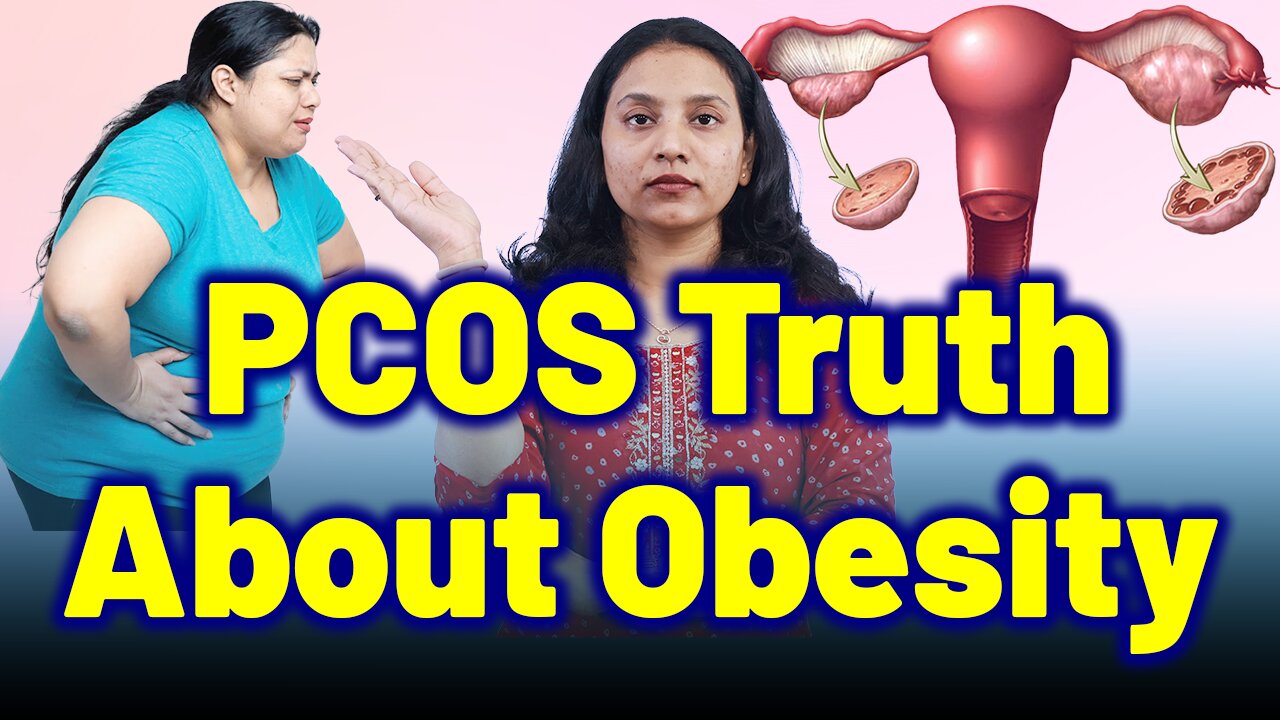 Truth About PCOS, Obesity, Weight Gain & Metabolism. | Treatment Cure Medicin | Gynaecology Women