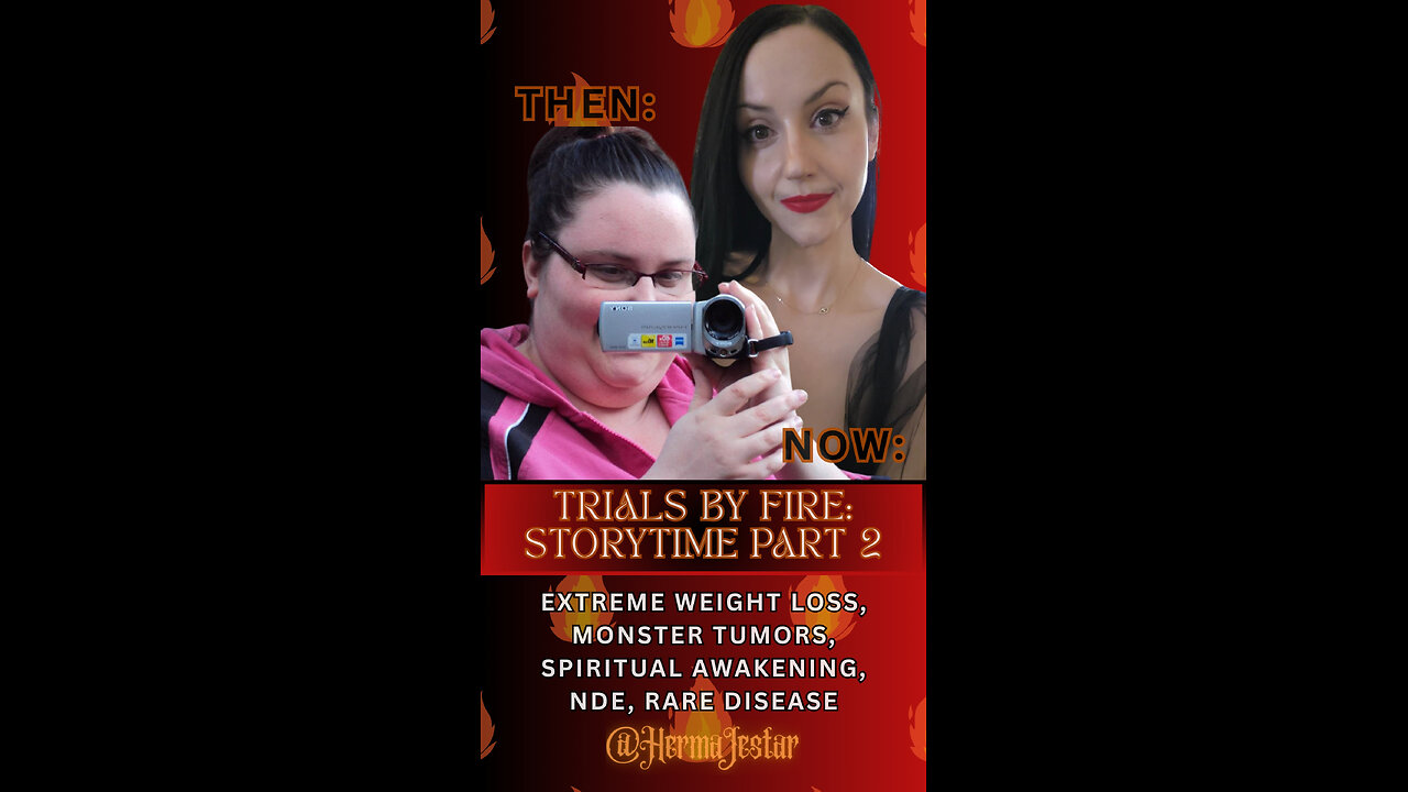 Trials by Fire: My Journey Through Extreme Weight Loss, Rare Disease, and Awakening - Part 2