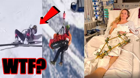 Lindsey Vonn gives SHOCKING UPDATE about SEVERE INJURY after CRASHING at Winter Olympics!
