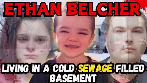 His Toe Was Rotting Off- The Story of Ethan Belcher