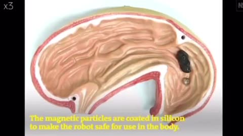 A MAGNETIC SLIME ROBOT IN YOUR BODY