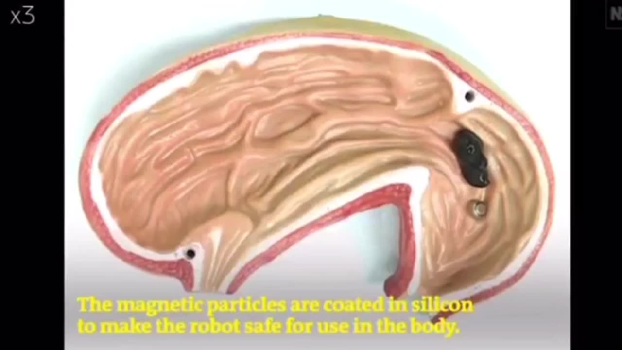 A MAGNETIC SLIME ROBOT IN YOUR BODY