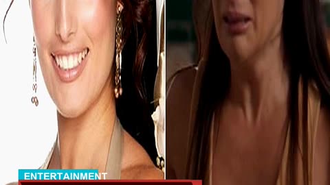 Ada Nicodemou Reveals the Results of Her Cosmetic
