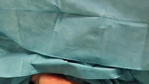 جراحی اعضای بدن