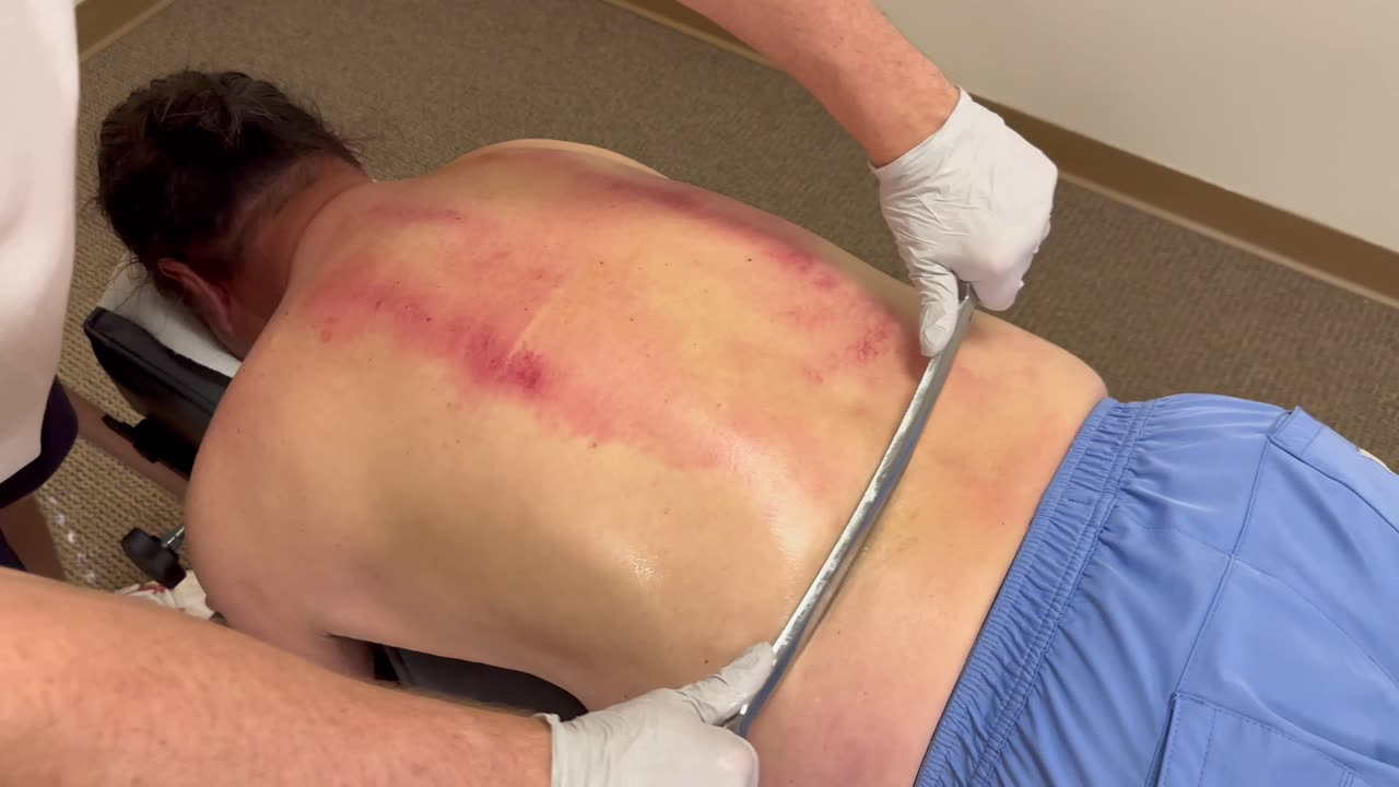 RELIEVING EXTREME KNOTS