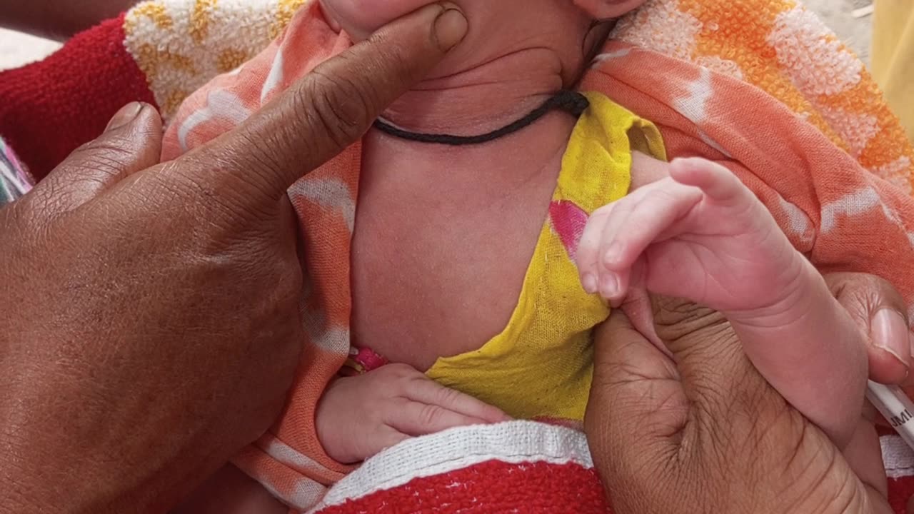 cute baby injection crying video video #shorts #trending #sui