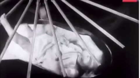 Contraption for infant leg muscle development in the 1940s