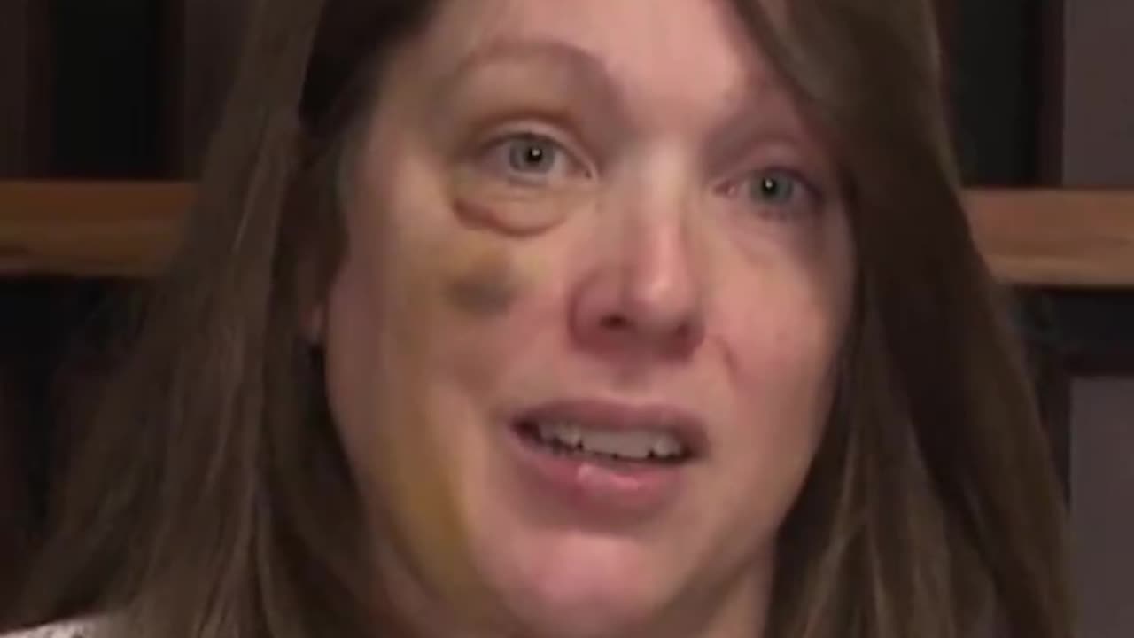 The Woman Who Was Brutally Beaten in Cincinnati Rips Local Leaders for Being Soft on Crime