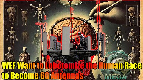 WEF Want to Lobotomize the Human Race to Become 6G Antennas (2023 broadcast) | + Link to doc. CLOT SHOT LOBOTOMY SYNDROME now in full effect for the injected masses as they suffer biological changes to their hypothalamus and frontal lobe 02/21/2025