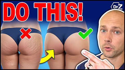 How Your Butt Shape Determine Metabolic Health - (Surprising Research!)