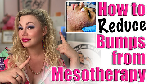 How to Reduce Swelling from Mesotherapy! Code Jessica10 Saves you money, Wannabe Beauty Guru