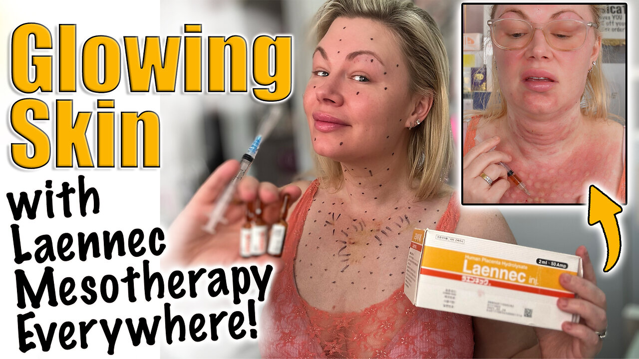 Glowing Skin with Laennec Meso Therapy EVERYWHERE! AceCosm.com and code Jessica10 Saves you Money