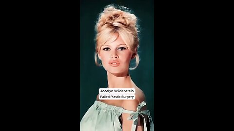 Failed plastic surgeries, holy crap, this is insane!! 🤯