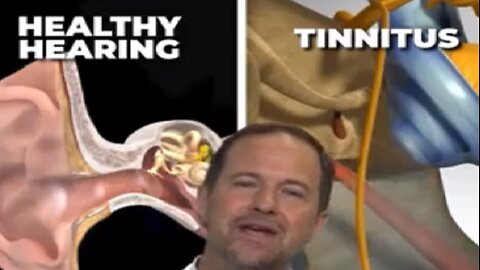 Unplug Your Stuck Ear Filter & Stop the Ringing