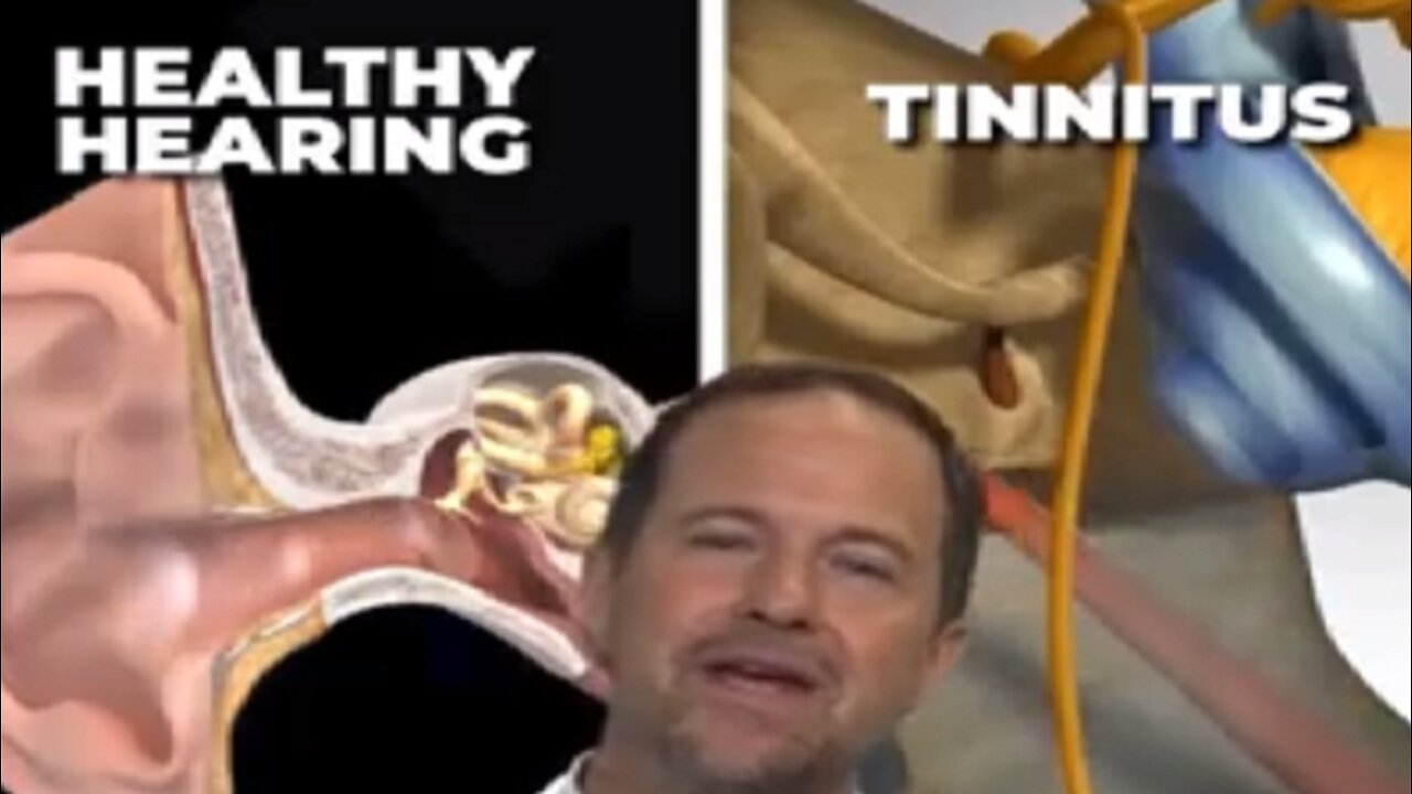 Unplug Your Stuck Ear Filter & Stop the Ringing