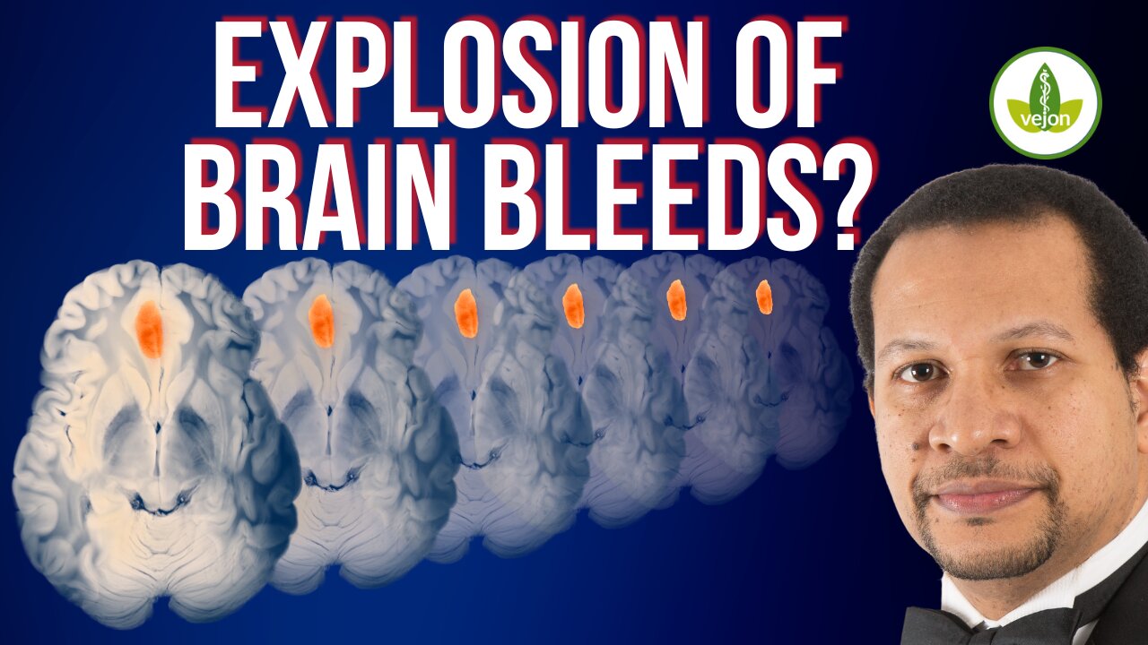 VAX SPIKE Protein Lingers in Brain Arteries for MONTHS?