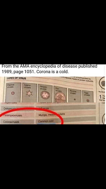 Pre-scamdemic medical textbook from 1989 shows that coronavirus is really just the common cold.
