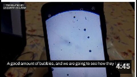 "Dr. Zelada's Optical Microscope Analysis of a Pfizer Vaccine Drop"