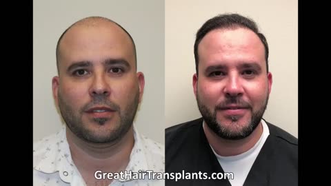Dr. Brett Bolton Best Hair Transplant Surgeon in Arizona - Phoenix - Promo