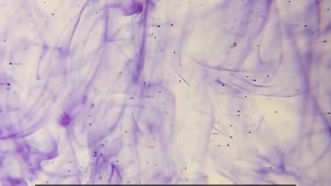 Daily Horoscope | Aquarius 🌟